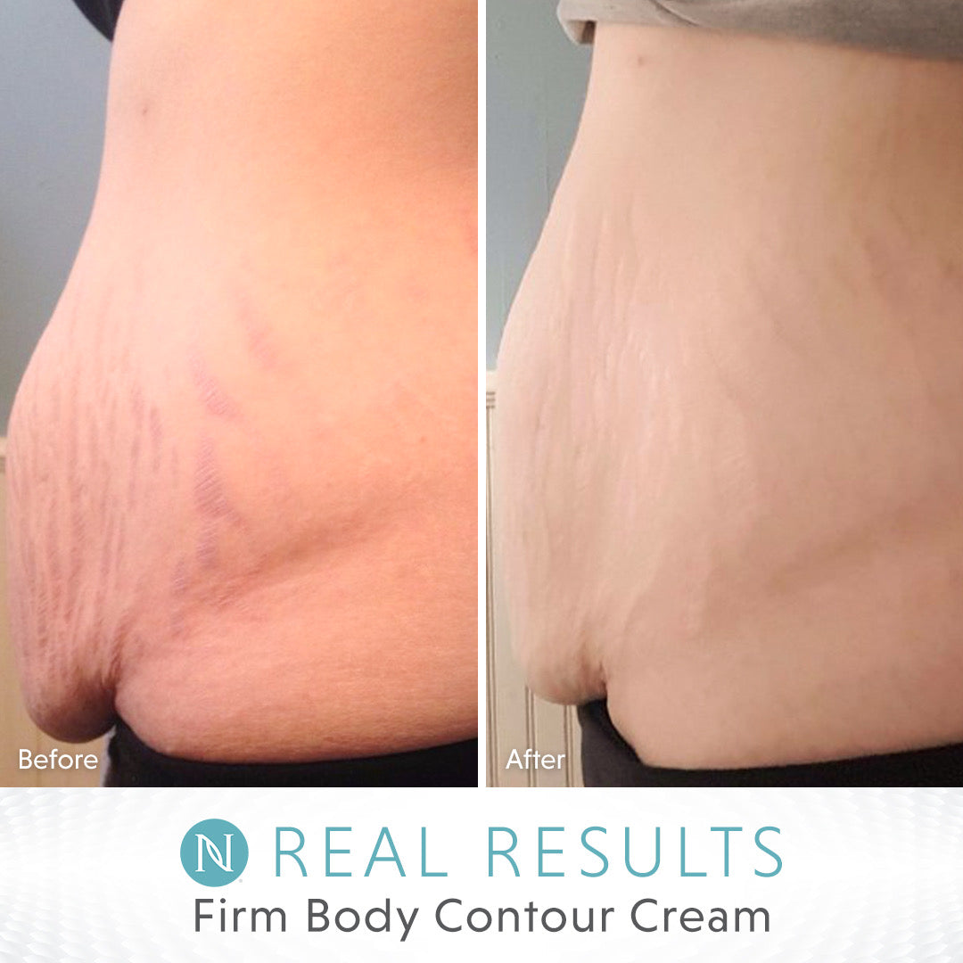 Neora Firm Cream - Downscale & Healthcare from Anywhere Online Shop