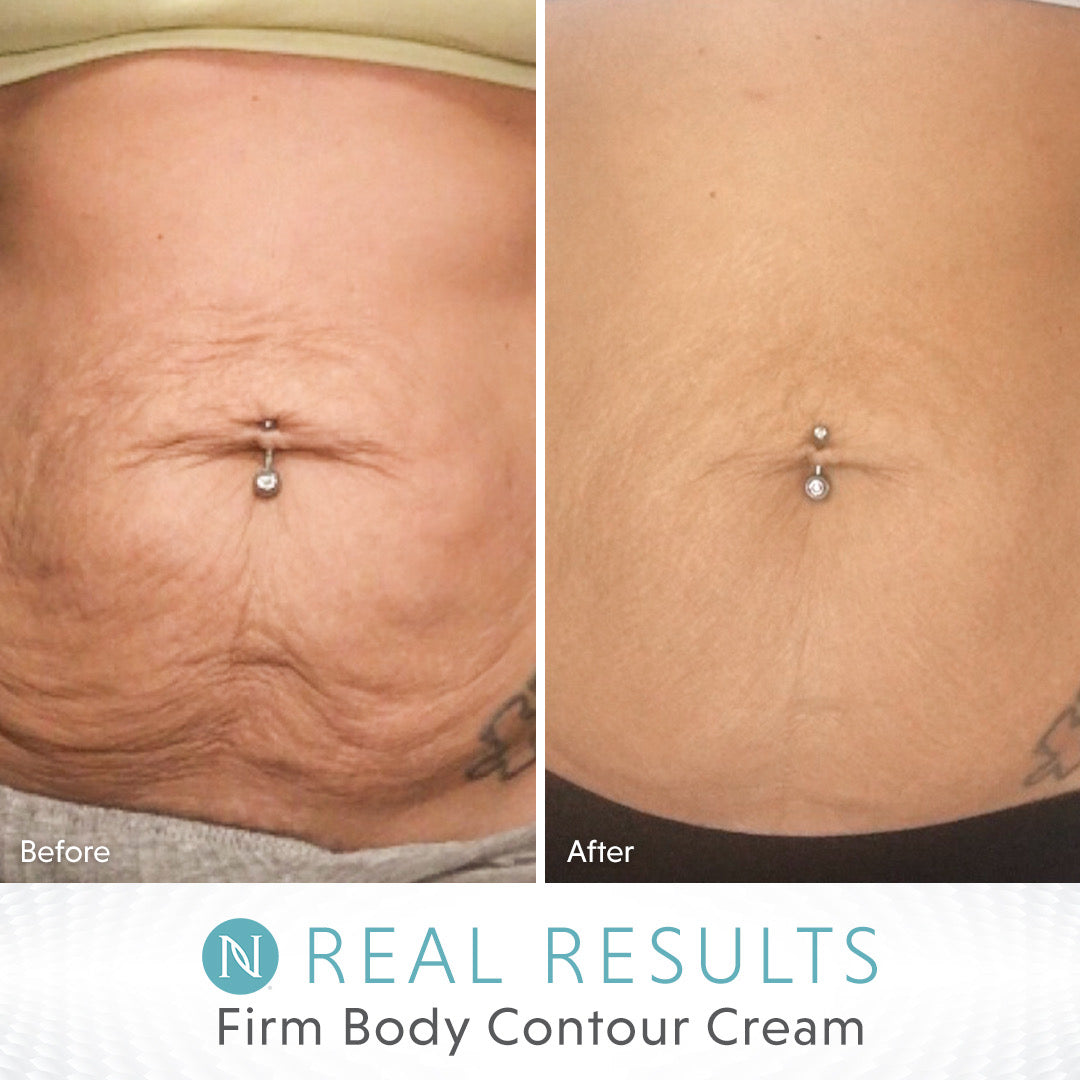 Neora Firm Cream - Downscale & Healthcare from Anywhere Online Shop